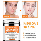 VitaminC Face Cream SkinCare Pigment Spots Freckles Remover brightening Moisturizing Anit-Aging Beauty Health Cosmetics
