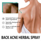 Herbal Acne Remover Spray Back Shoulder Pimple Treatment Blackhead Anti Mites Oil Control Repair Smooth Skin Care Beauty Health