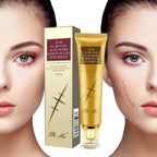 TCM Scar and Acne Mark Removal Gel Ointment packaging with a woman's face showing scars.