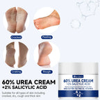 60% Urea Foot Cream for Cracked Heels & Dry Skin - Intensive Moisturizing Treatment, Callus Remover, Diabetic Foot Care.
