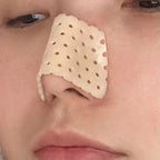 Low Temperature Thermoplastic Board Beauty Fracture Splints High Nose Bridge Reusable Health Care Brace Nasal Shaping Corrector