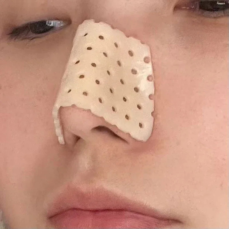 Low Temperature Thermoplastic Board Beauty Fracture Splints High Nose Bridge Reusable Health Care Brace Nasal Shaping Corrector