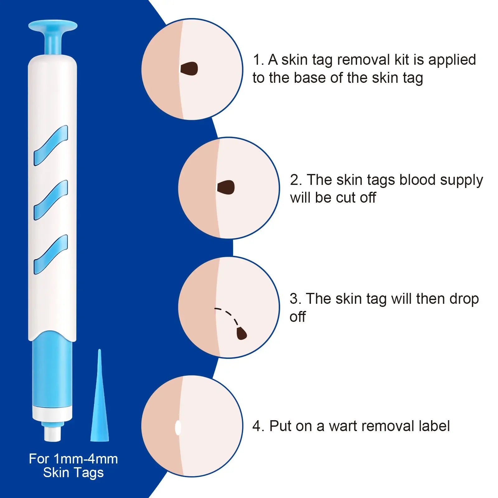 2 In1 Painless Auto Skin Tag Mole Wart Removal Kit Cleaning Tools Face Skin Care Body Wart Dot Treatments Remover Beauty Health