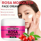 Rosehip Skincare Cream: Hydrating Serum & Moisturizing Cream