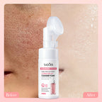 Sadoer cleanser foam bottle with 'Before' and 'After' skin comparison on a pink background