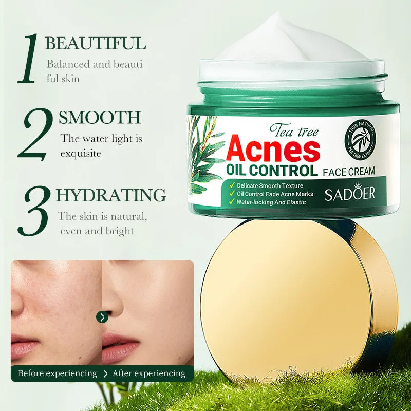 Tea Tree Acne Removing Face Cream Anti Acne Hydrating Oil Control Moisturizing Facial Creams Face Skin Care Products