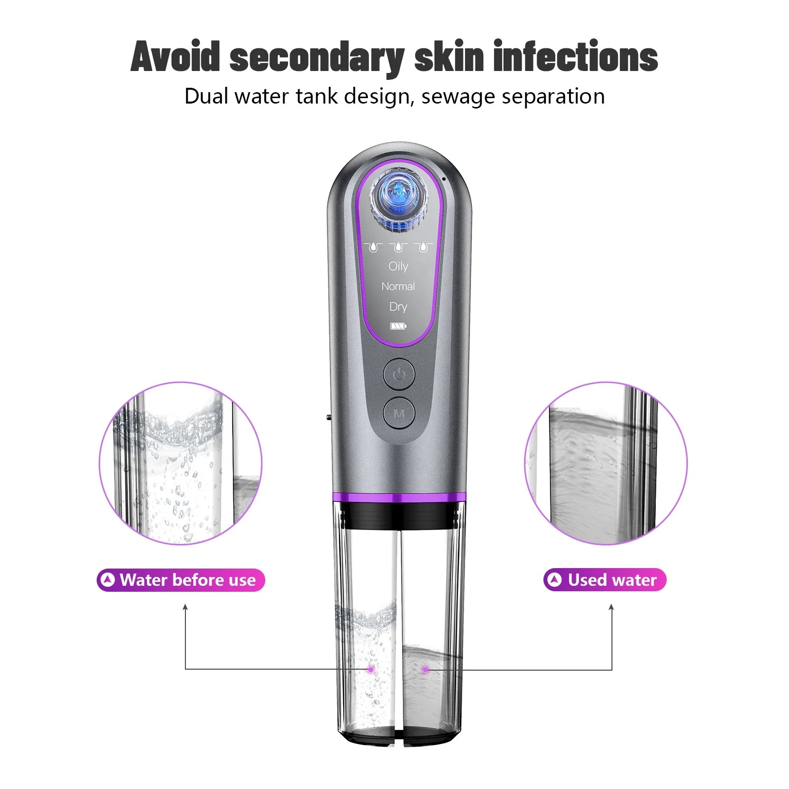 Beauty Product Facial Cleaner Electric Micro Small Bubble Water Cycle Acne Pore Vacuum Blackhead Remover Device