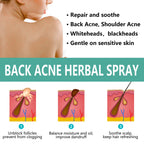 Herbal Acne Remover Spray Back Shoulder Pimple Treatment Blackhead Anti Mites Oil Control Repair Smooth Skin Care Beauty Health