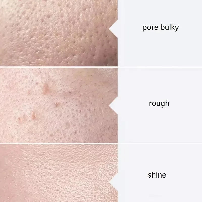 3PCS Skincare Deep Cleansing AS1 SA2 AO3 Water based Exfoliating Liquid Pore Shrinking Moisturizing Liquid Beauty Salon Facial