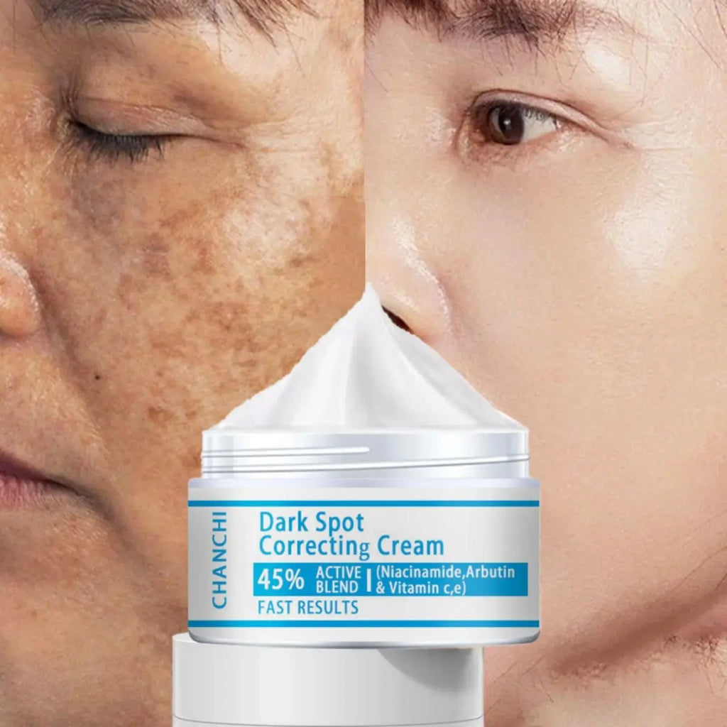 Unisex Dark Spot & Freckle Brightening Face Cream