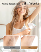 IPL Hair Removal Device with 999900 Flashes and 3-in-1 Modes