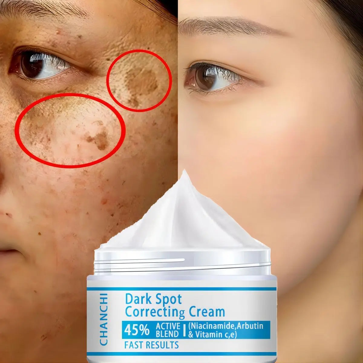 Unisex Dark Spot & Freckle Brightening Face Cream