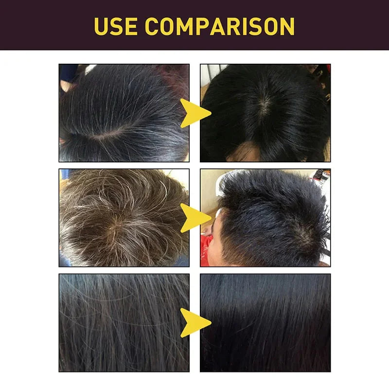 3-in-1 Herbal Hair Color Shampoo for Gray Hair Care 20240226