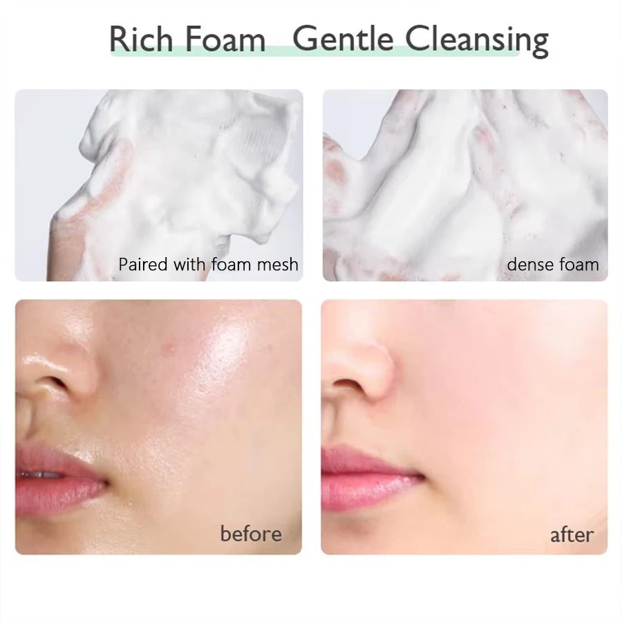 Unisex Whitening Moisturizing Foam Facial Cleanser 20200238 3.4 fl oz
