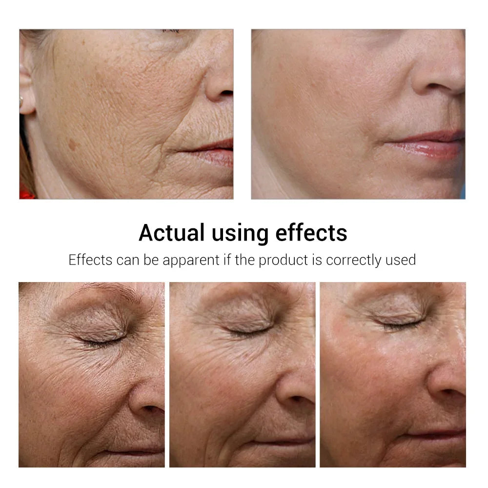 Hoygi Retinol Anti-Aging Facial Skincare Treatment Serum and Cream