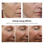 Hoygi Retinol Anti-Aging Facial Skincare Treatment Serum and Cream