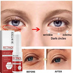 Hoygi Retinol Anti-Aging Facial Skincare Treatment Serum and Cream