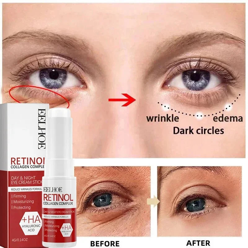 Hoygi Retinol Anti-Aging Facial Skincare Treatment Serum and Cream