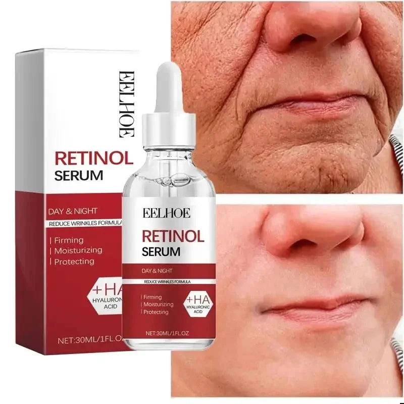Hoygi Retinol Anti-Aging Facial Skincare Treatment Serum and Cream