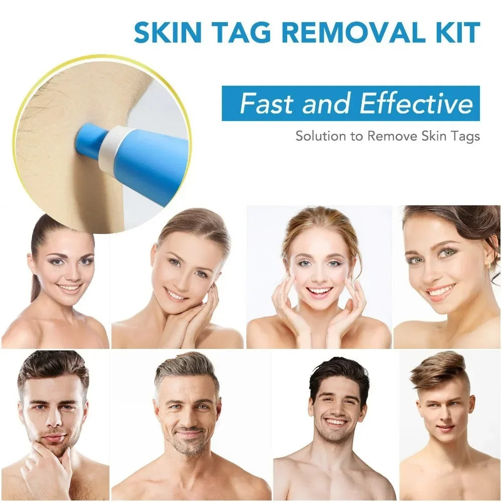 Unisex 2-in-1 Painless Auto Skin Tag & Mole Removal Kit