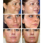 Unisex Dark Spot & Freckle Brightening Face Cream