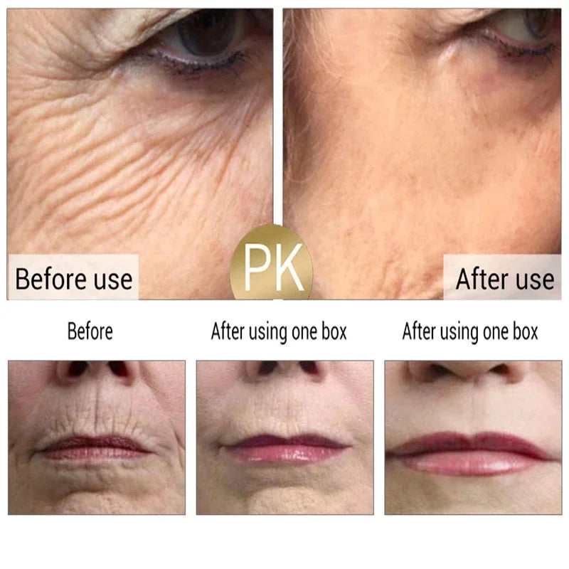 Hoygi Retinol Anti-Aging Facial Skincare Treatment Serum and Cream