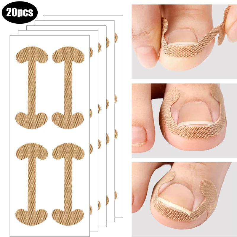 20-100pcs Adhesive Toenail Patch Ingrown Toe Nail Correction Sticker Foot Corrector Pedicure Health Care Tools Toe Treatment Pad