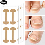 20-100pcs Adhesive Toenail Patch Ingrown Toe Nail Correction Sticker Foot Corrector Pedicure Health Care Tools Toe Treatment Pad