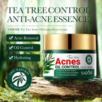 Tea Tree Acne Removing Face Cream Anti Acne Hydrating Oil Control Moisturizing Facial Creams Face Skin Care Products