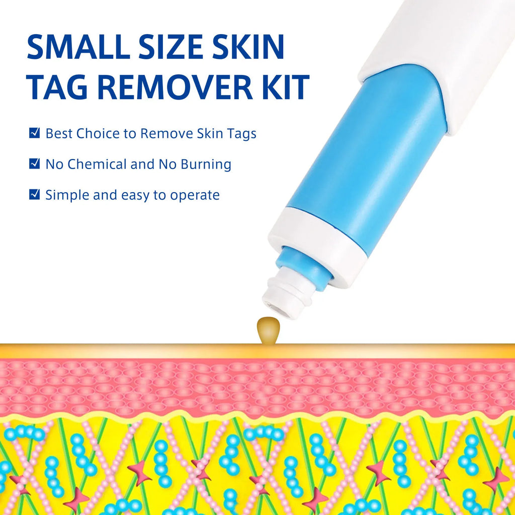 2 In1 Painless Auto Skin Tag Mole Wart Removal Kit Cleaning Tools Face Skin Care Body Wart Dot Treatments Remover Beauty Health