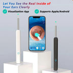 Smart Visual Ear Cleaner HD Ear Sticks Otoscope USB C Charging Endoscope Wax Removal Tool Earpick MIni Camera Health Care Set
