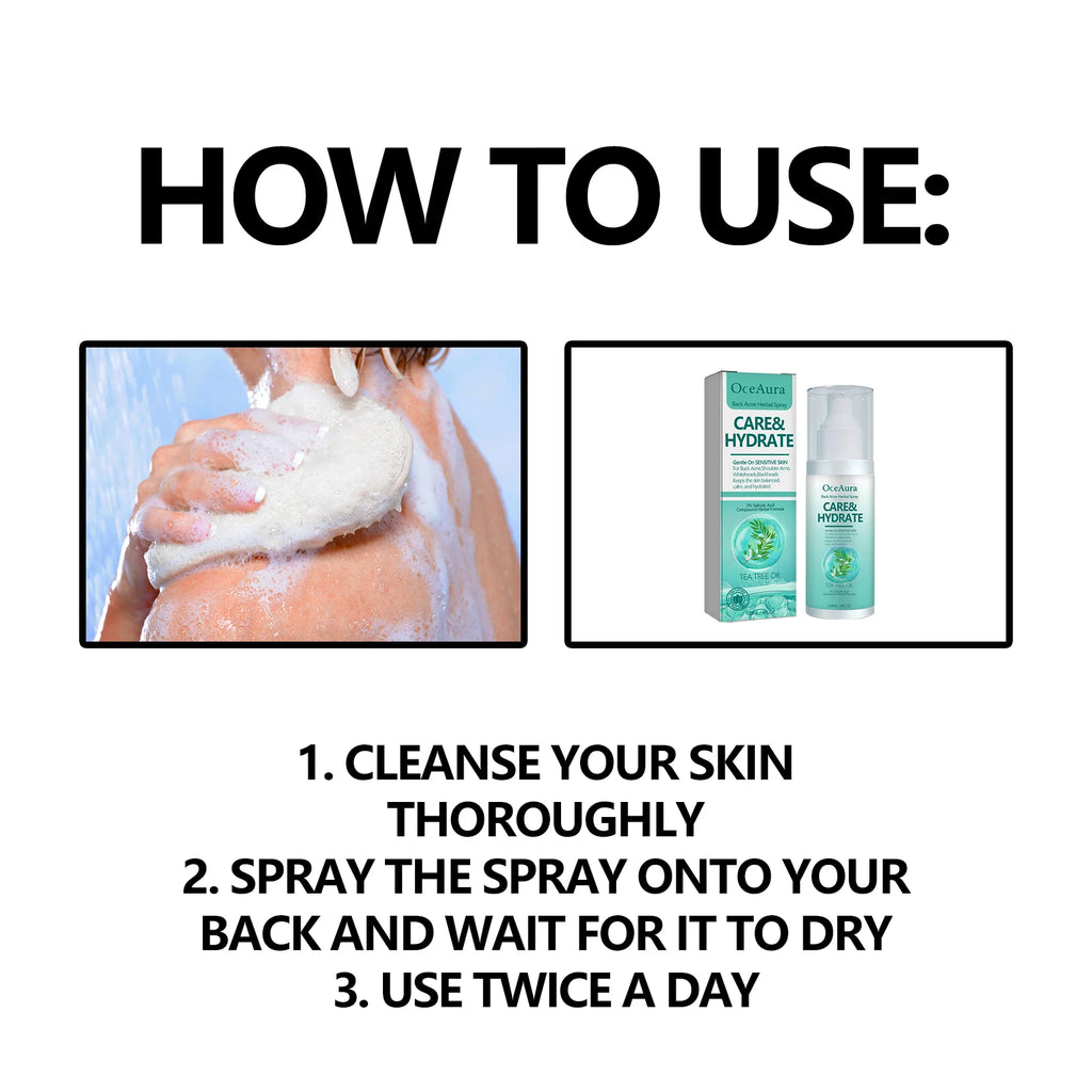 Herbal Acne Remover Spray Back Shoulder Pimple Treatment Blackhead Anti Mites Oil Control Repair Smooth Skin Care Beauty Health