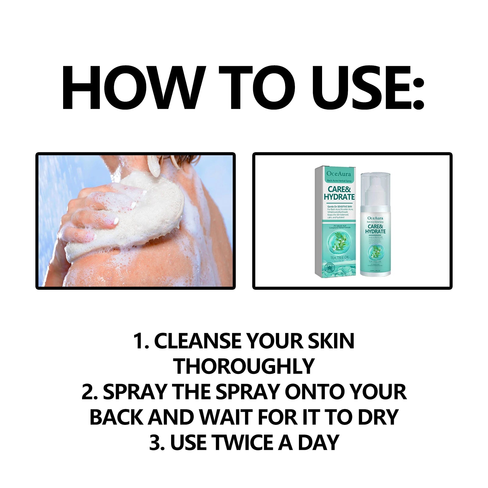 Herbal Acne Remover Spray Back Shoulder Pimple Treatment Blackhead Anti Mites Oil Control Repair Smooth Skin Care Beauty Health
