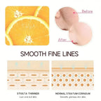 VitaminC Face Cream SkinCare Pigment Spots Freckles Remover brightening Moisturizing Anit-Aging Beauty Health Cosmetics