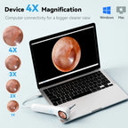 Digital Ear Camera with 1.21 Inch IPS Screen1080p HD Smart Visual Ear Care with tool for Ear/ Nose/Mouth/Pet/Skin Care Health
