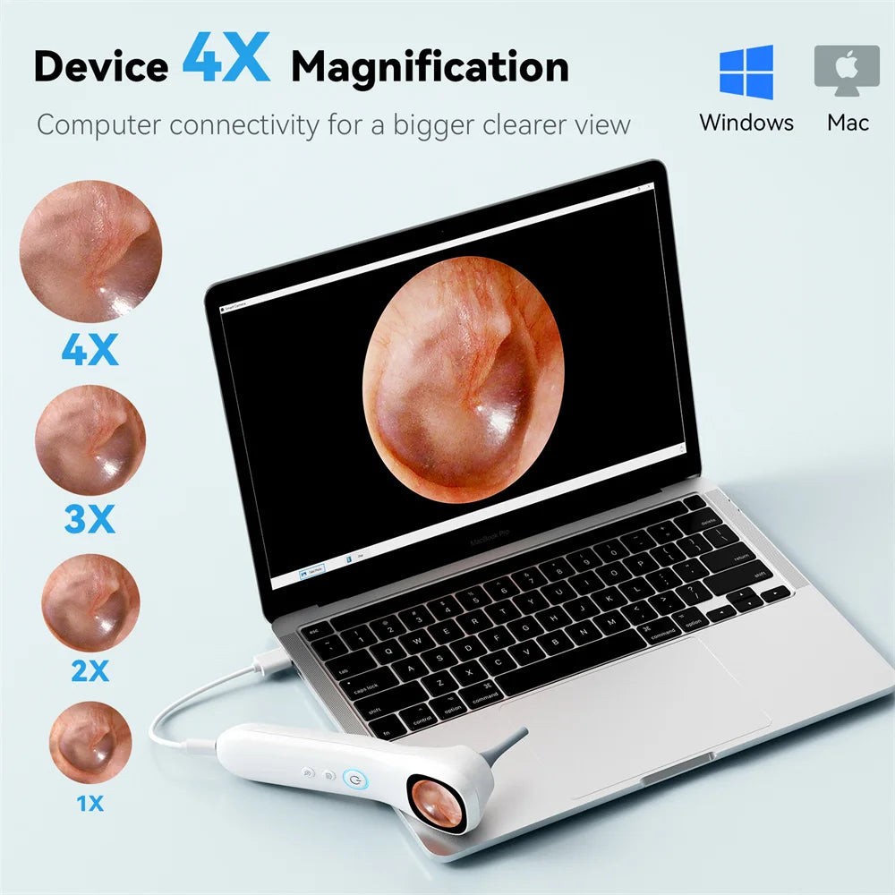 Digital Ear Camera with 1.21 Inch IPS Screen1080p HD Smart Visual Ear Care with tool for Ear/ Nose/Mouth/Pet/Skin Care Health